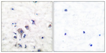mGluR-2/3 rabbit pAb