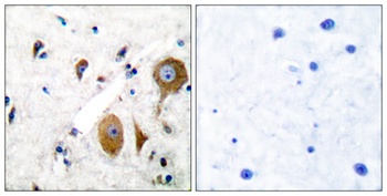 mGluR-8 rabbit pAb
