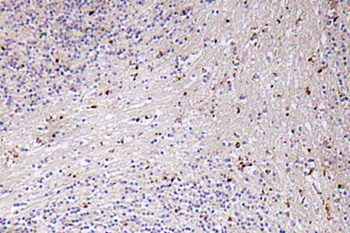 GRO alpha antibody