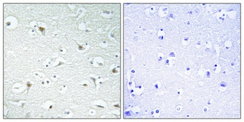 TFIIA-α rabbit pAb
