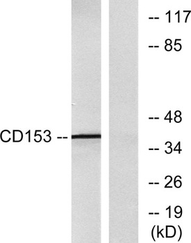 CD30-L antibody