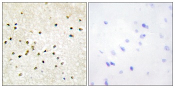 TFIIH p62 antibody