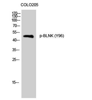 BLNK (phospho Tyr96) rabbit pAb