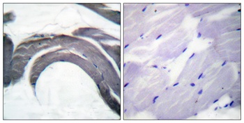 Glycogen Synthase 1 (phospho Ser645) rabbit pAb Antibody