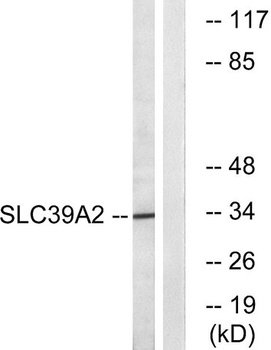 ZIP2 antibody