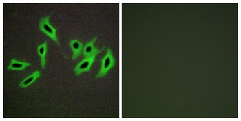 HC-II antibody