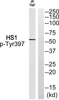 Lck BP-1 (phospho-Tyr397) antibody