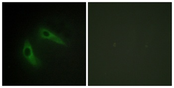 KChIP1 antibody