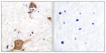 Neuregulin-1 SMDF rabbit pAb