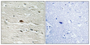 HMG-14 (phospho Ser21) rabbit pAb