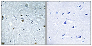 HMG-17 (phospho Ser29) rabbit pAb