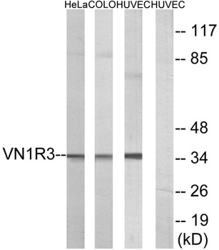 V1RL3 antibody