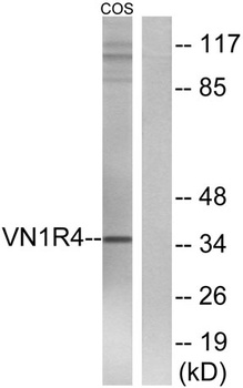 VN1R4 rabbit pAb Antibody