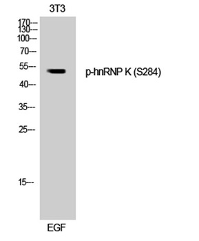 hnRNP K (phospho Ser284) rabbit pAb