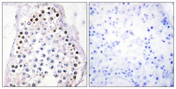 Hox-A1/B1/D1 rabbit pAb