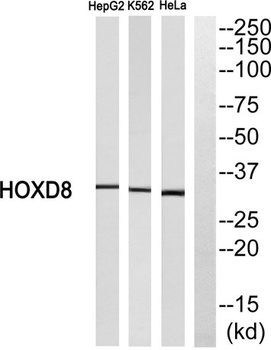 HoxD8 antibody