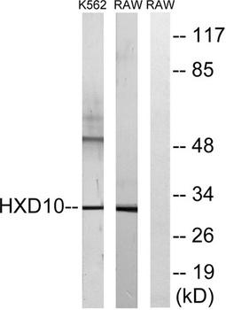 HoxD10 antibody