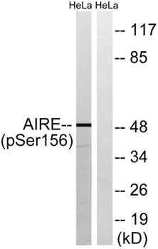 AIRE-1 (phospho-Ser156) antibody