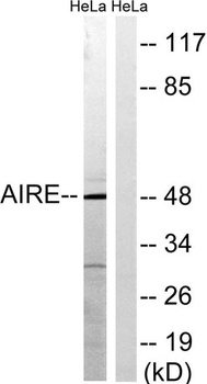 AIRE-1 antibody
