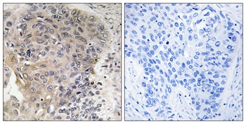 CCP3 antibody