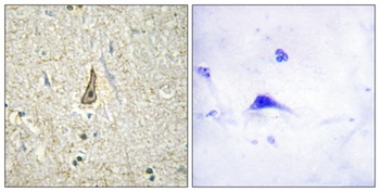 CYP26C1 rabbit pAb