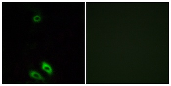AKR1CL1 rabbit pAb Antibody