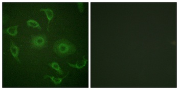 IFN-α/βRα rabbit pAb