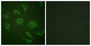 IFN-alpha/beta R alpha antibody