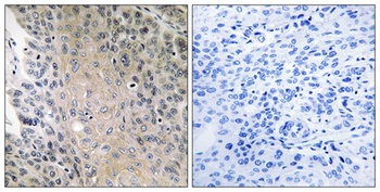 Rab 41 antibody