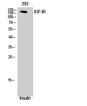 IGF-IR antibody