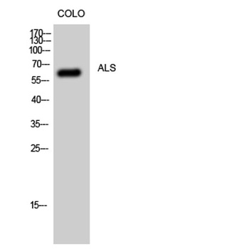 ALS antibody