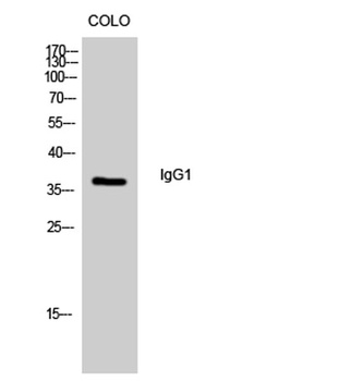IgG1 antibody