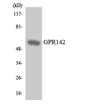 GPR142 rabbit pAb Antibody