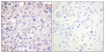 IKK beta (phospho-Tyr188) antibody