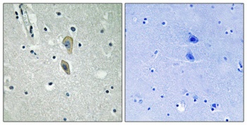 IL1RI (phospho-Tyr496) antibody