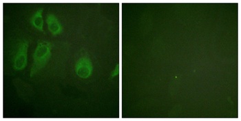 IL2R alpha antibody