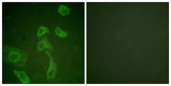 IL2R beta antibody