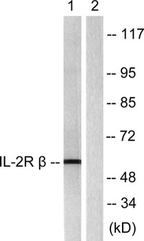 IL-2Rβ rabbit pAb Antibody