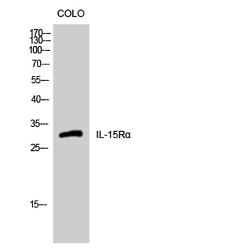 IL15R alpha antibody