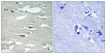 ILK (phospho Ser246) rabbit pAb