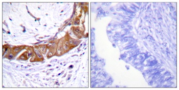 IRAK-1 (phospho Thr100) rabbit pAb