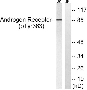 AR (phospho-Tyr363) antibody