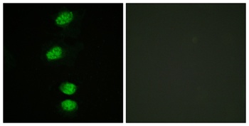 AR (phospho-Ser94) antibody
