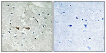 Integrin α4 (phospho Ser1027) rabbit pAb