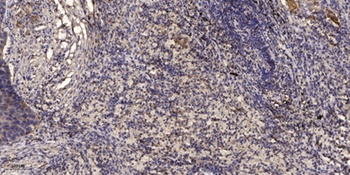 A-Raf (phospho-Ser299) antibody