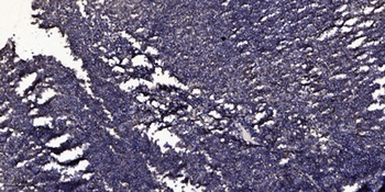 Cleaved-ITI-H4 70k (R661) antibody