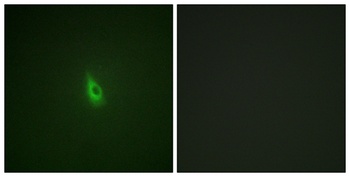 IP3R-I (phospho Ser1598) rabbit pAb Antibody
