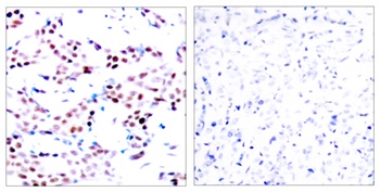 AP-1 (phospho Thr91) rabbit pAb