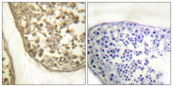 AP-1 (phospho Thr231) rabbit pAb Antibody