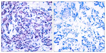 Jun D (phospho Ser255) rabbit pAb